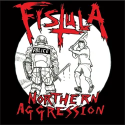 fistula northernaggression